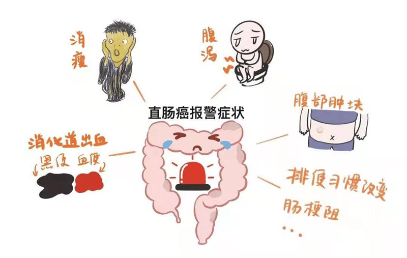 【州醫(yī)科普】劉明澤：大腸癌的預(yù)防與治療