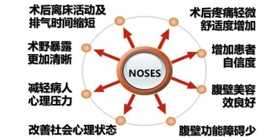 胃腸腹壁疝外科成功實施腹壁無輔助切口的腹腔鏡直腸癌根治術(shù)